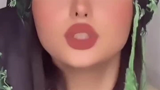 دلبر کاشت مو