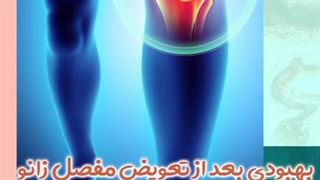 بهبودی بعد از تعویض مفصل زانو در سالمندان چقدر طول می کشد؟