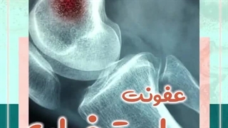 عفونت استخوان