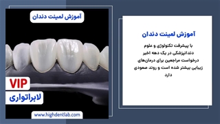 آموزش ساخت لمینت دندان