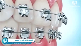 بهترین کلینیک ارتودنسی در مشهد
