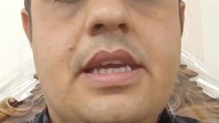 درمان زخم بستر در منزل