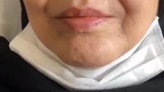 خدمات پاکسازی پوست بروجرد