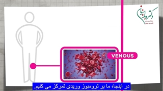 ترومبوز قلبی