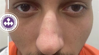 ساخت ویدئوی قبل و بعد