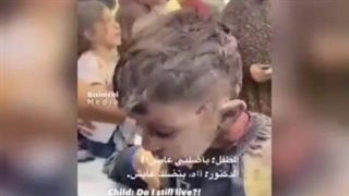 دکتر،من زنده می مانم؟ کاشت مو