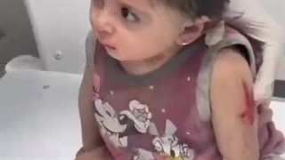 The innocent child in Gaza who is shocked and has no family anymore