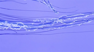 حقایق عجیب حیوانات: حیوانات شگفت انگیزی که بعد از مرگ زنده می مانند