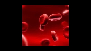 هموکروماتوز