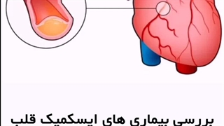 کاربردهای سی تی آنژیو