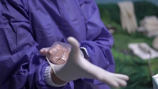 کاشت مو در مشهد اقساطی