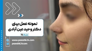 دکتر وحید عین آبادی بهترین دکتر جراح بینی در شیراز اکستنشن تاج دندان