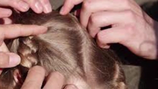 بهترین روش برای از بین بردن شپش با کوکاکولا