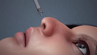 عمل بینی استخوانی