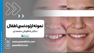 دکتر مهیار ماهوش محمدی متخصص ارتودنسی کودکان در تهران پروتز سینه