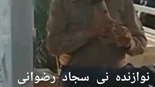 سجاد رضوانی برداشتن خال