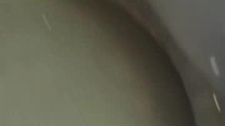 ایمپلنت کار حرفه ای 8