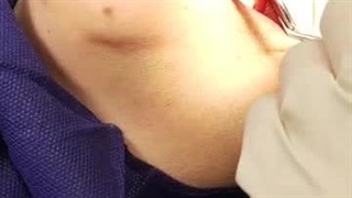 ایمپلنت کار حرفه ای 9