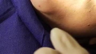 ایمپلنت کار حرفه ای 11