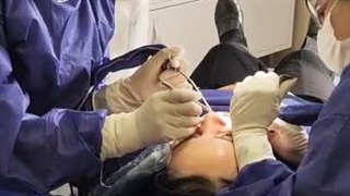 بهترین متخصص ایمپلنت شیان کلینیک-12