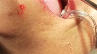 بهترین متخصص ایمپلنت در تهرانپارس14