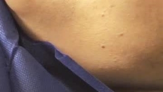 متخصص ایمپلنت