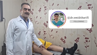 پارگی مینیسک خارجی زانو