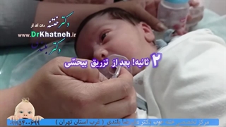 مجهزترین مرکز ختنه نوزادان کودکان تهران کرج بدون بیهوشی بدون درد تضمینی