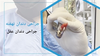 ایمپلنت آمریکایی
