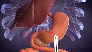 بهترین دکتر اسلیو معده در تهران