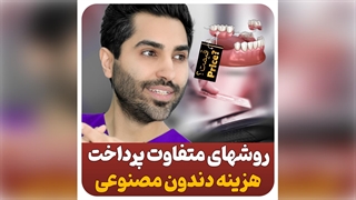 نحوه پرداخت هزینه دندانپزشکی با بیمه