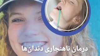 ایمپلنت آمریکایی