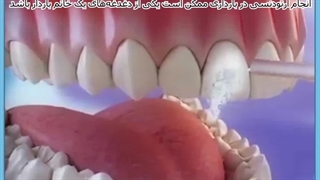 ارتودنسی در بارداری