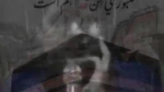 الله الله الله - ابوالفضل قاسم پور لیزر مو