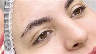 مرکز تخصصی ابرو چشم لب