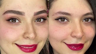 مرکز تخصصی ابرو چشم لب