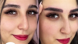 مرکز تخصصی ابرو چشم لب