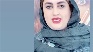 مرکز تخصصی ابرو چشم لب