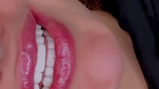 بارانا، بهترین دندانپزشکی مشهد