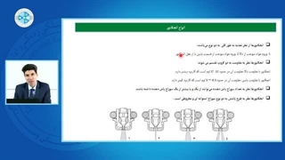 سیستم سوخت رسانی بنزینی و گازی -درس7 -انواع سوزن انژکتور