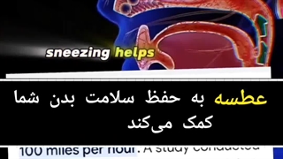 معجزه اللهی تزریق ژل