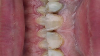 دندانپزشکی زیبایی و ترمیمی
