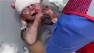 + 18 آنچه در غزه برای کودکان و نوگلان فلسطینی توسط ارتش کودک کش صهیونیستی بوجود آمده