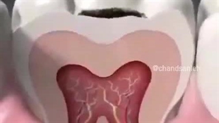 پر کردن دندان دیگه راحت شد