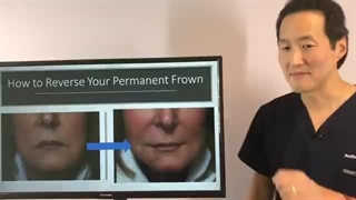 جراحی افتادگی گوشه‌های لب