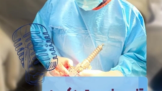 تنوسینوویت دکرون