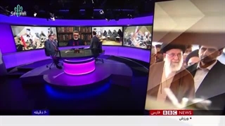 14021013: آیا آیت الله خامنه ای مبتلا به مگالومنیا شده؟