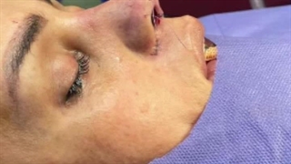 عمل جراحی نیمه فانتزی