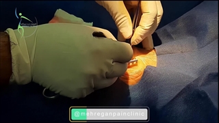 سی تی اس دست. دکتر وحید شاملی. متخصص ارتوپد کلینیک درد مهرگان