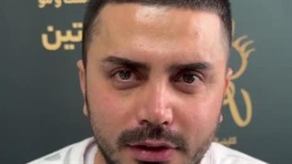 بهترین دکتر حراحی پلک در کلینیک آرتین